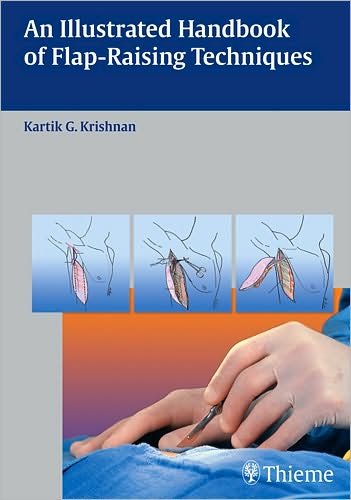 An Illustrated Handbook of Flap-Raising Techniques - Kartik G. Krishnan - Livros - Thieme Publishing Group - 9783131477613 - 6 de agosto de 2008