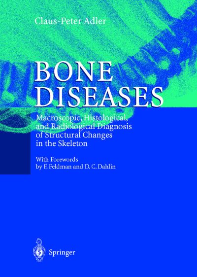 Cover for Claus-Peter Adler · Bone Diseases: Macroscopic, Histological, and Radiological Diagnosis of Structural Changes in the Skeleton (Hardcover Book) [2000 edition] (1999)