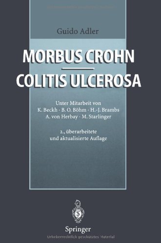 Cover for Guido Adler · Morbus Crohn - Colitis Ulcerosa (Paperback Bog) [2nd 2. Aufl. 1996. Softcover Reprint of the Origin edition] (2011)