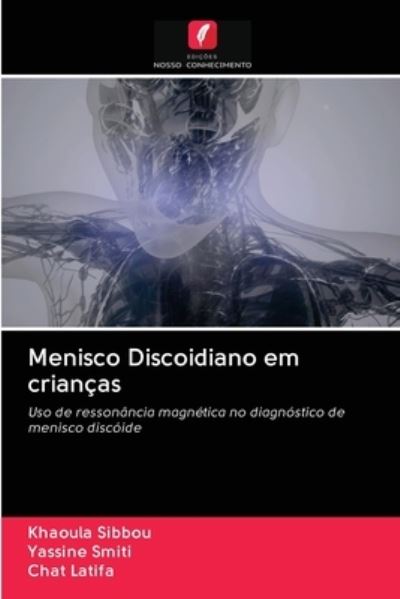 Cover for Khaoula Sibbou · Menisco Discoidiano em crianças : Uso de ressonância magnética no diagnóstico de menisco discóide (Pocketbok) (2020)