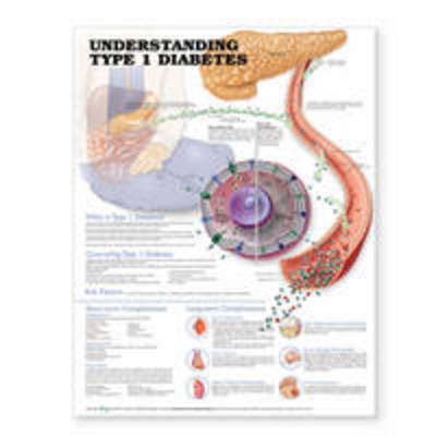 Cover for Acc · Understanding Type 1 Diabetes 2e Paper (N/A)