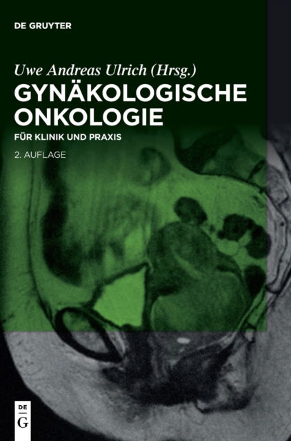 Cover for Uwe Andreas Ulrich · Gynakologische Onkologie (Innbunden bok) (2021)