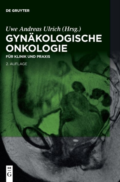 Cover for Uwe Andreas Ulrich · Gynakologische Onkologie (Hardcover Book) (2021)