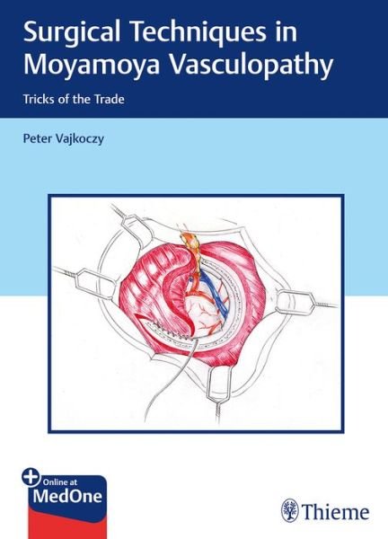 Surgical Techniques in Moyamoya Vasculopathy: Tricks of the Trade - Peter Vajkoczy - Books - Thieme Publishing Group - 9783131450616 - October 9, 2019