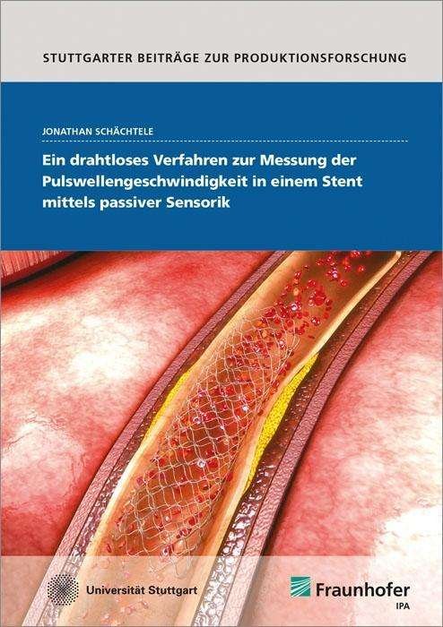 Cover for Schächtele · Ein drahtloses Verfahren zur (Book)