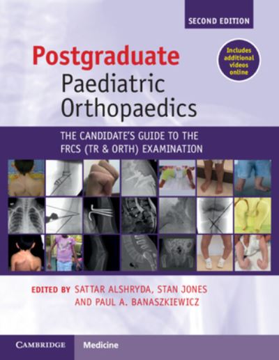 Postgraduate Paediatric Orthopaedics: The Candidate's Guide to the FRCS (Tr&Orth) Examination -  - Books - Cambridge University Press - 9781108970617 - February 1, 2024