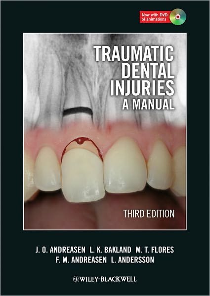 Traumatic Dental Injuries: A Manual - Andreasen, Jens O. (University Hospital (Rigshospitalet), Copenhagen, Denmark) - Bøker - John Wiley and Sons Ltd - 9781405190619 - 5. april 2011