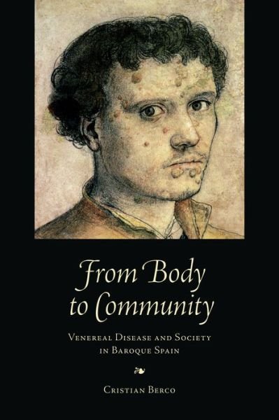 Cristian Berco · From Body to Community: Venereal Disease and Society in Baroque Spain - Toronto Iberic (Hardcover Book) (2016)