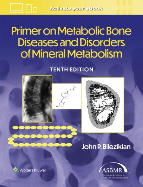 Primer on the Metabolic Bone Diseases and Disorders of Mineral Metabolism - John P. Bilezikian - Bücher - Wolters Kluwer Health - 9781975215620 - 15. Februar 2025