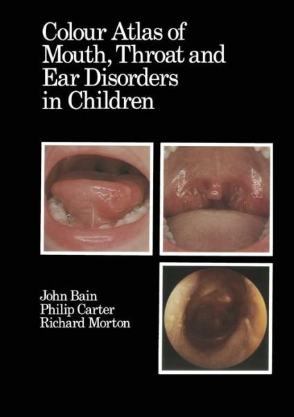 Colour Atlas of Mouth, Throat and Ear Disorders in Children - D J Bain - Boeken - Springer - 9789401086622 - 12 oktober 2011