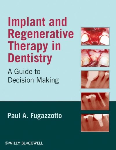 Cover for Fugazzotto, Paul A. (Private Practice, Milton, Massachusetts) · Implant and Regenerative Therapy in Dentistry: A Guide to Decision Making (Hardcover bog) (2009)