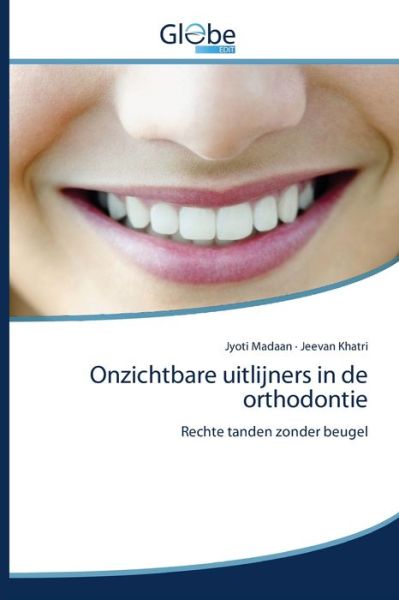 Onzichtbare uitlijners in de orthodontie - Jyoti Madaan - Books - Globeedit - 9786139419623 - April 13, 2020