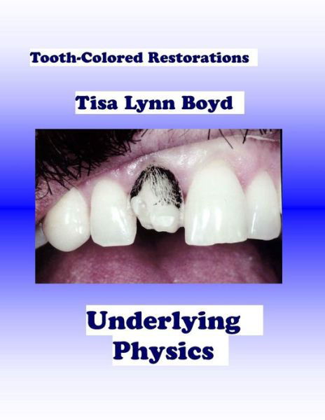 Cover for Tisa Lynn Boyd · Tooth-colored Restorations: Underlying Physics (Paperback Book) (2012)