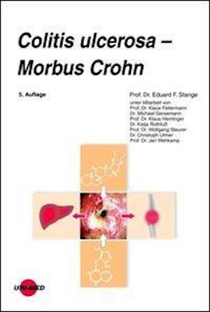 Cover for Stange · Colitis ulcerosa - Morbus Crohn (Book)