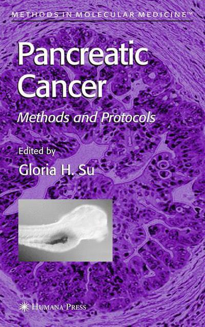 Cover for Pancreatic Cancer: Methods and Protocols - Methods in Molecular Medicine (Paperback Book) [Softcover reprint of hardcover 1st ed. 2005 edition] (2010)