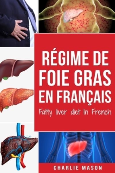 Cover for Charlie Mason · Regime de foie gras En francais/ Fatty liver diet In French (Paperback Book) (2020)