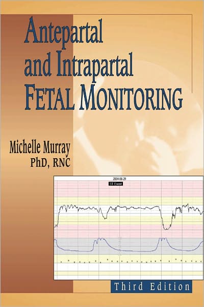 Cover for Michelle Murray · Antepartal and Intrapartal Fetal Monitoring (Paperback Book) [Third edition] (2006)