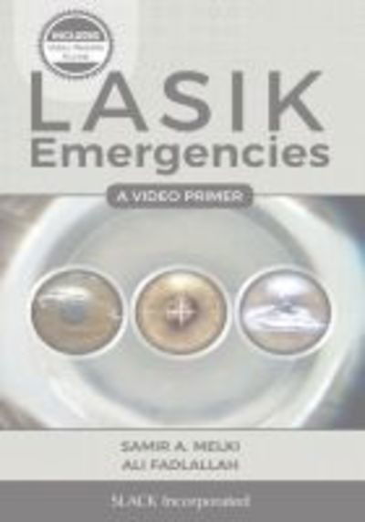 LASIK Emergencies: A Video Primer - Samir A. Melki - Books - SLACK  Incorporated - 9781630912628 - December 15, 2017