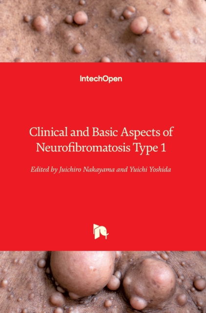 Cover for Juichiro Nakayama · Clinical and Basic Aspects of Neurofibromatosis Type 1 (Hardcover bog) (2022)