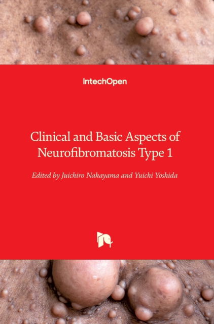 Cover for Juichiro Nakayama · Clinical and Basic Aspects of Neurofibromatosis Type 1 (Hardcover Book) (2022)