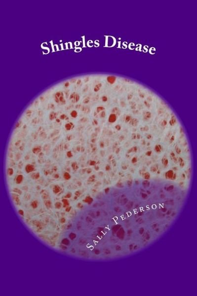 Cover for Sally Pederson · Shingles Disease: the Complete Guide (Pocketbok) (2012)