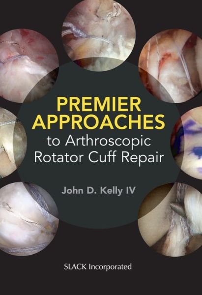 Cover for John Kelly · Premier Approaches to Arthroscopic Rotator Cuff Repair (Paperback Book) (2020)