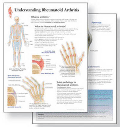 Cover for Scientific Publishing · Understanding Arthritis Study Set Replacement Pads: Patient Education Study Sets (Pocketbok) (2015)