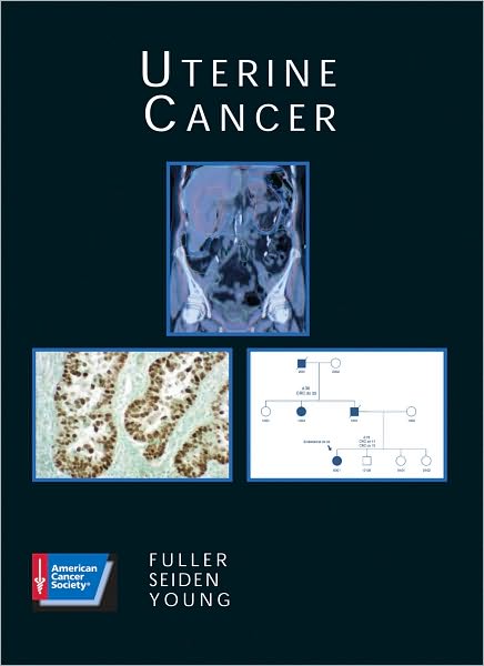 Uterine Cancer - Fuller - Książki - B.C. Decker Inc - 9781550091632 - 16 października 2003