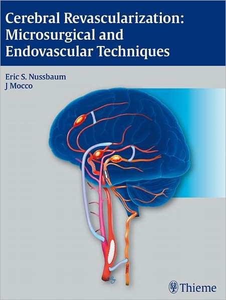 Cerebral Revascularization: Microsurgical and Endovascular Techniques - Eric Nussbaum - Books - Thieme Medical Publishers Inc - 9781604062632 - January 4, 2011