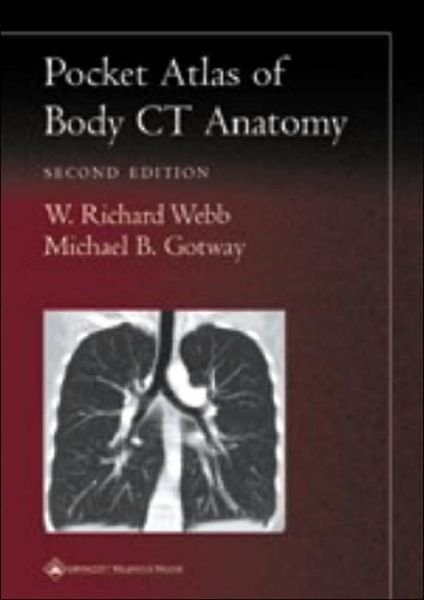 Pocket Atlas of Body CT Anatomy - Radiology Pocket Atlas Series - W. Richard Webb - Livros - Lippincott Williams and Wilkins - 9780781736633 - 12 de fevereiro de 2002