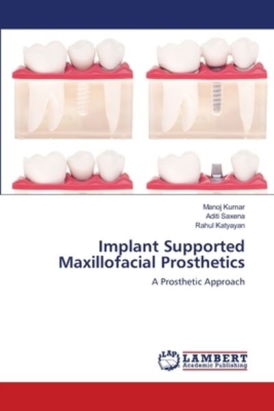 Implant Supported Maxillofacial P - Kumar - Inne -  - 9786203042634 - 15 grudnia 2020