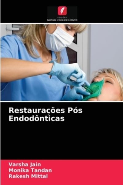 Cover for Jain · Restaurações Pós Endodônticas (N/A) (2021)