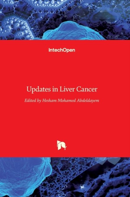 Cover for Hesham Abdeldayem · Updates in Liver Cancer (Innbunden bok) (2017)
