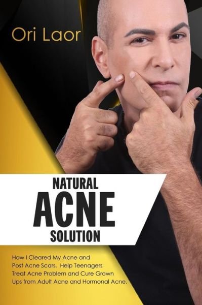 Cover for Ori Laor · Natural Acne Solution (Paperback Book) (2017)