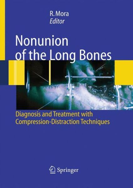 Cover for Redento Mora · Nonunion of the Long Bones: Diagnosis and treatment with compression-distraction techniques (Paperback Book) [2006 edition] (2014)