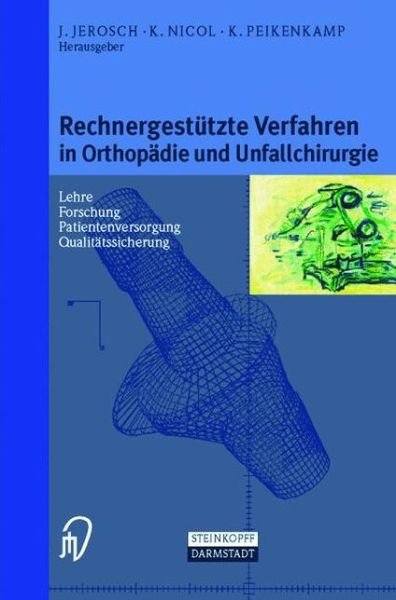 Cover for Jvrg Jerosch · Rechnergestutzte Verfahren in Orthopadie Und Unfallchirurgie (Taschenbuch) [1999 edition] (1999)