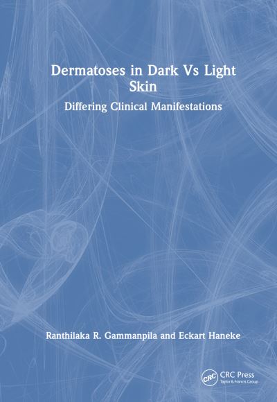 Cover for Gammanpila, Ranthilaka R. (Teaching Hospital Kalutara, Sri Lanka) · Dermatoses in Dark Vs Light Skin: Differing Clinical Manifestations (Hardcover Book) (2025)