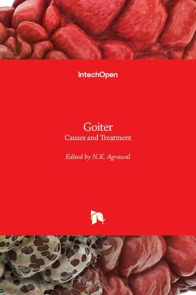 Cover for N.K. Agrawal · Goiter: Causes and Treatment (Hardcover Book) (2020)