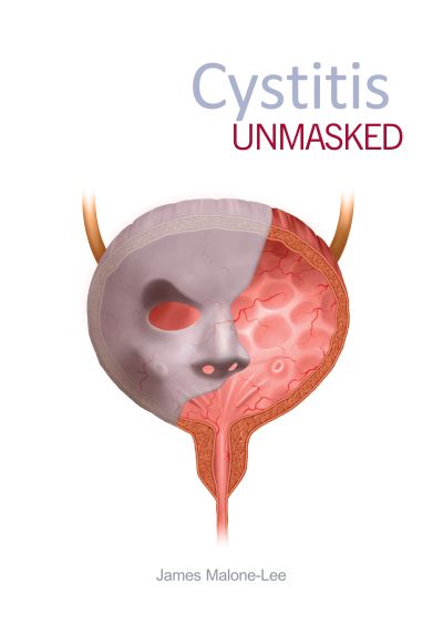 Cover for James Malone-Lee · Cystitis Unmasked (Taschenbuch) (2021)