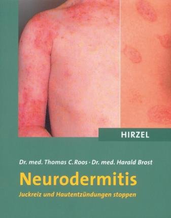 Cover for Thomas C. Roos · Neurodermitis. Juckreiz und Hautentzündungen stoppen (Taschenbuch) (2004)
