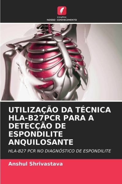 Cover for Anshul Shrivastava · Utilizacao Da Tecnica Hla-B27pcr Para a Deteccao de Espondilite Anquilosante (Paperback Book) (2021)