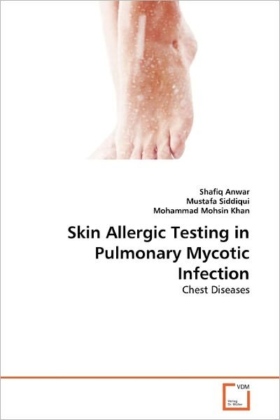 Cover for Anwar · Skin Allergic Testing in Pulmonar (Book)