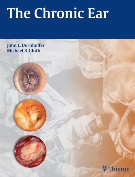 The Chronic Ear - John L. Dornhoffer - Bøger - Thieme Medical Publishers - 9781604068641 - 15. april 2016