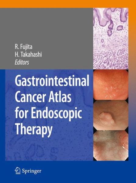 Cover for Gastrointestinal Cancer Atlas for Endoscopic Therapy (Hardcover Book) [2009 edition] (2009)