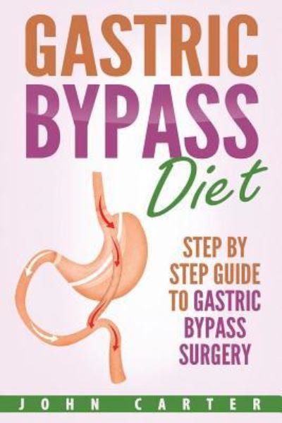 Cover for John Carter · Gastric Bypass Diet: Step By Step Guide to Gastric Bypass Surgery - Bariatric Cookbook (Paperback Book) (2019)