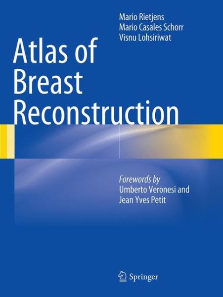 Cover for Mario Rietjens · Atlas of Breast Reconstruction (Paperback Book) [Softcover reprint of the original 1st ed. 2015 edition] (2016)