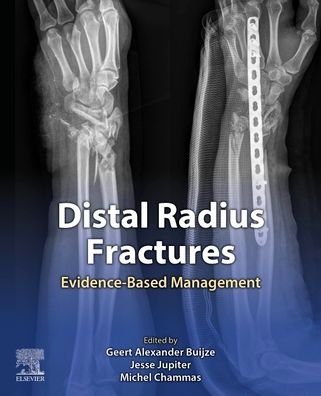 Cover for Jupiter · Distal Radius Fractures: Evidence-Based Management (Inbunden Bok) (2021)
