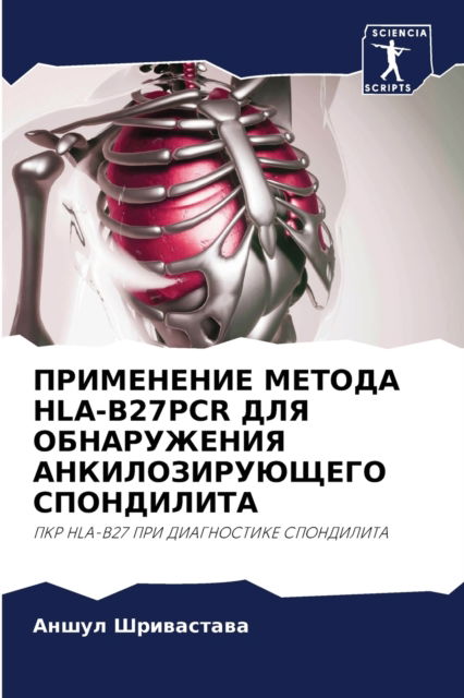 ?????????? ?????? Hla-b27pcr ??? ??????????? ???? - ????? ?????????? - Books - Sciencia Scripts - 9786203239645 - September 20, 2021