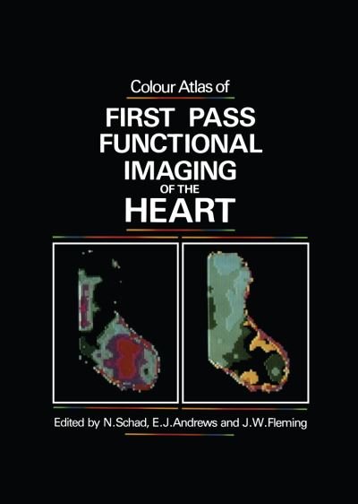 Cover for N Schad · Colour Atlas of First Pass Functional Imaging of the Heart (Paperback Bog) [Softcover reprint of the original 1st ed. 1985 edition] (2011)