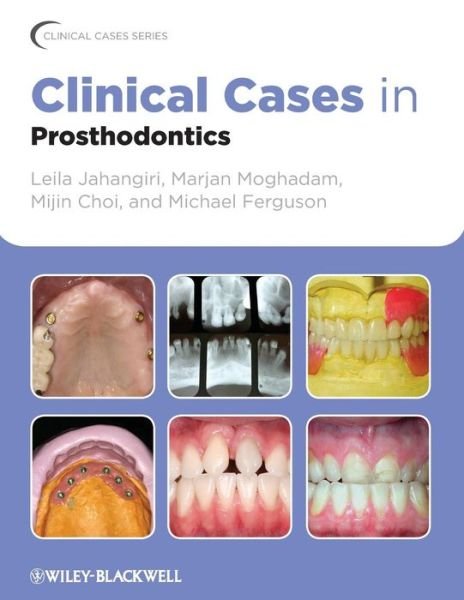 Cover for Jahangiri, Leila (New York University College of Dentistry, USA) · Clinical Cases in Prosthodontics - Clinical Cases (Dentistry) (Pocketbok) (2010)